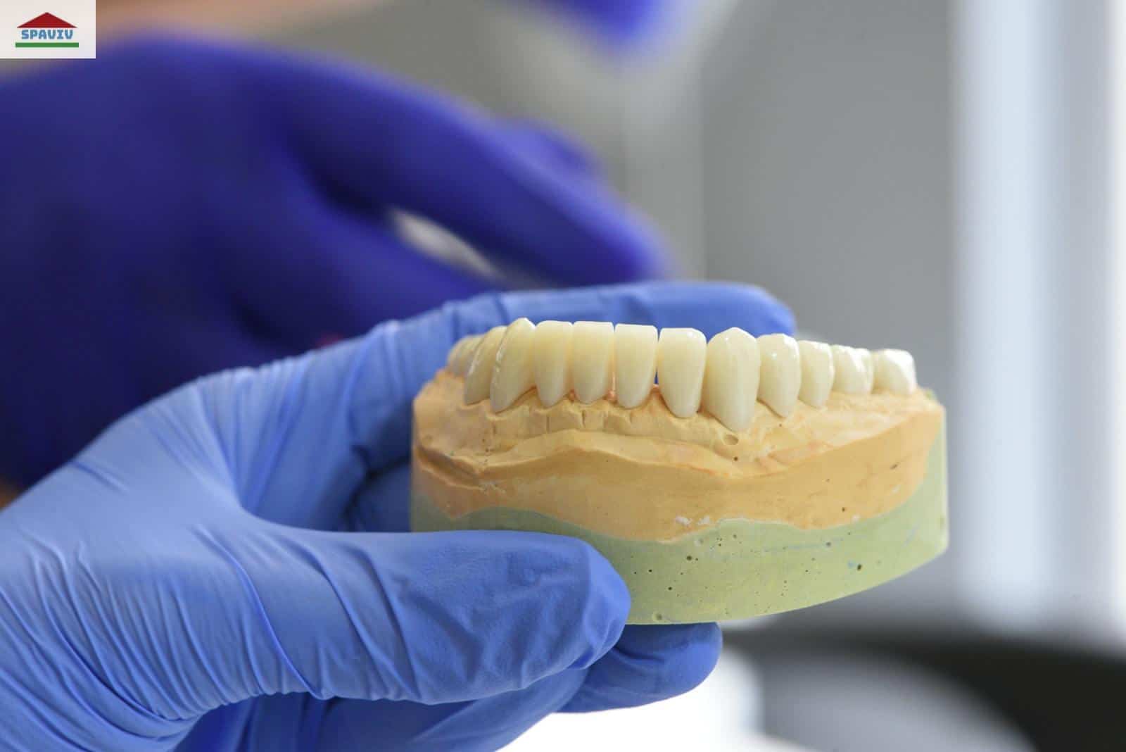 Close-up of a dental model held by gloved hands in a laboratory setting.